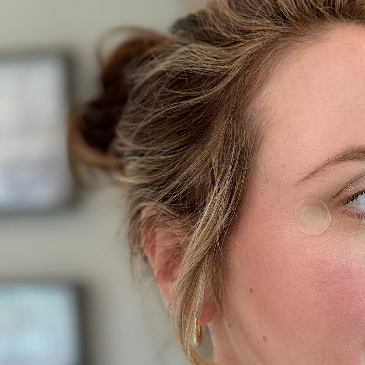 Blemish & Wrinkle Patch with Microneedle Technology